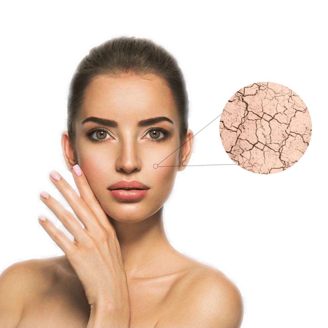 Dry skin