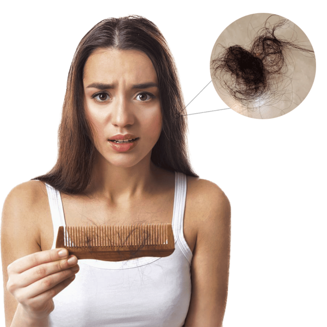 Hairfall