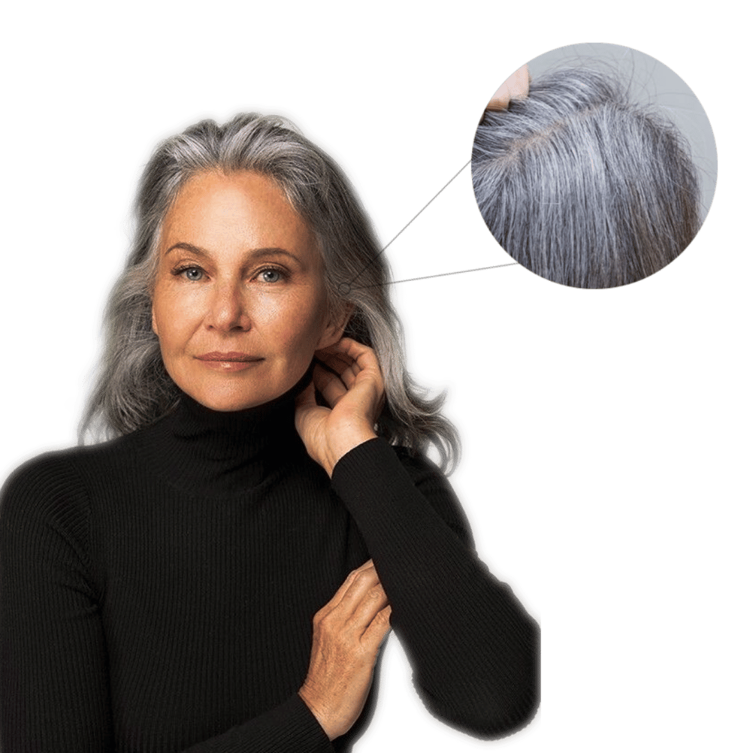 Premature grey hair