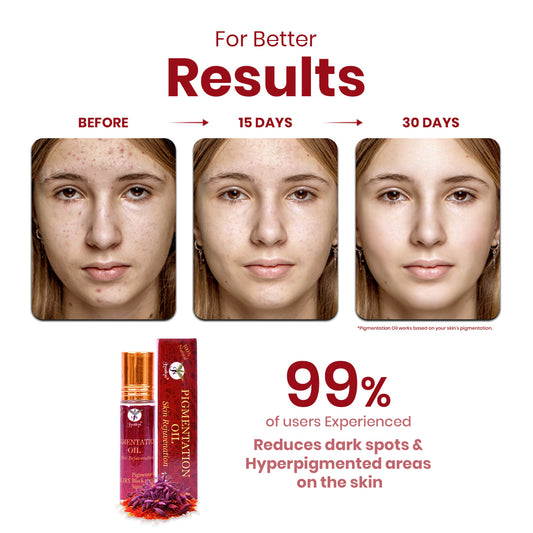 Pigmentation Oil – 10 ml of Saffron